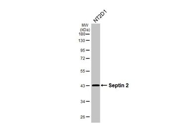 Anti-Septin 2 antibody used in Western Blot (WB). GTX101774