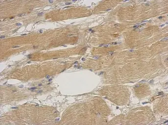 Anti-Septin 2 antibody used in IHC (Paraffin sections) (IHC-P). GTX101774