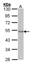 Anti-CtBP1 antibody [N3C3] used in Western Blot (WB). GTX101775