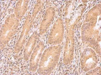 Anti-IMPDH2 antibody used in IHC (Paraffin sections) (IHC-P). GTX101778
