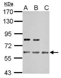 Anti-IMPDH2 antibody used in Western Blot (WB). GTX101778