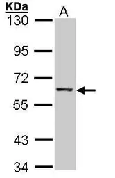 Anti-IMPDH2 antibody used in Western Blot (WB). GTX101778