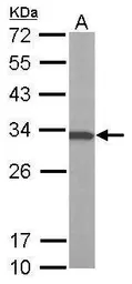 Anti-ATP6V1E1 antibody [N1C3] used in Western Blot (WB). GTX101799
