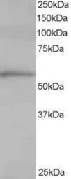 Anti-TCP1 alpha antibody, C-term used in Western Blot (WB). GTX10180