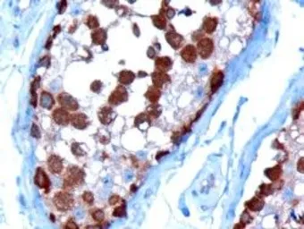 Anti-TCP1 alpha antibody, C-term used in IHC (Paraffin sections) (IHC-P). GTX10180