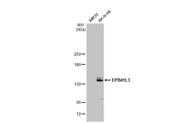 Anti-EPB41L3 antibody [C3], C-term used in Western Blot (WB). GTX101805