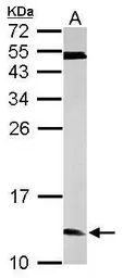 Anti-ERH antibody used in Western Blot (WB). GTX101806