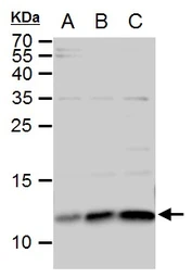 Anti-ERH antibody used in Western Blot (WB). GTX101806