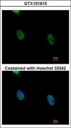 Anti-hnRNP K antibody used in Immunocytochemistry/ Immunofluorescence (ICC/IF). GTX101815