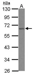 Anti-hnRNP K antibody used in Western Blot (WB). GTX101815