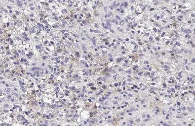 Anti-HPCAL1 antibody [N1C3] used in IHC (Paraffin sections) (IHC-P). GTX101816