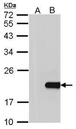 Anti-HPCAL1 antibody [N1C3] used in Western Blot (WB). GTX101816