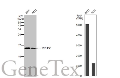 Anti-RPLP2 antibody used in Western Blot (WB). GTX101823