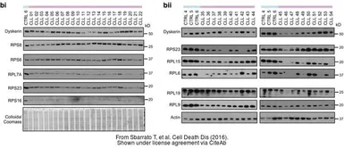 Anti-RPL15 antibody used in Western Blot (WB). GTX101830