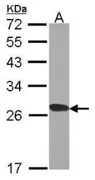 Anti-RPL15 antibody used in Western Blot (WB). GTX101830