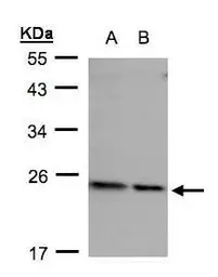 Anti-RPL17 antibody [N1C3] used in Western Blot (WB). GTX101831