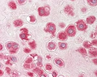 Anti-RPLP1 antibody [N1C3] used in IHC (Paraffin sections) (IHC-P). GTX101835
