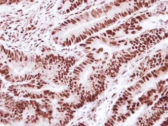 Anti-SNRPD2 antibody used in IHC (Paraffin sections) (IHC-P). GTX101846