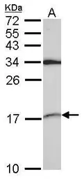 Anti-SNRPD2 antibody used in Western Blot (WB). GTX101846