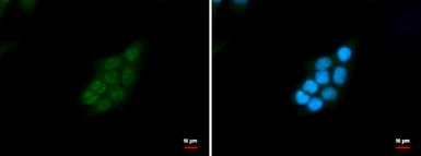 Anti-SNRPD2 antibody used in Immunocytochemistry/ Immunofluorescence (ICC/IF). GTX101846