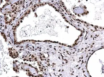 Anti-SNRPD2 antibody used in IHC (Paraffin sections) (IHC-P). GTX101846