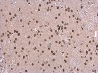 Anti-SNRPD2 antibody used in IHC (Paraffin sections) (IHC-P). GTX101846