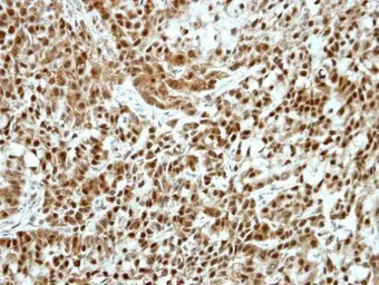 Anti-Ku70 antibody [N1N3] used in IHC (Paraffin sections) (IHC-P). GTX101848