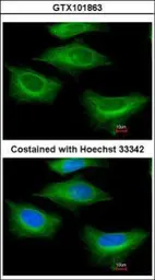 Anti-beta Tubulin 2 antibody [N1C1] used in Immunocytochemistry/ Immunofluorescence (ICC/IF). GTX101863