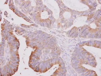 Anti-beta Tubulin 2 antibody [N1C1] used in IHC (Paraffin sections) (IHC-P). GTX101863