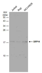 Anti-SRP14 antibody [N1C3] used in Western Blot (WB). GTX101867