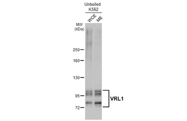 Anti-VRL1 antibody [C2C3], C-term used in Western Blot (WB). GTX101868