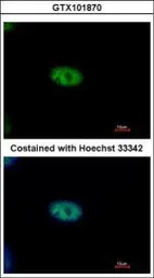 Anti-NYREN18 antibody used in Immunocytochemistry/ Immunofluorescence (ICC/IF). GTX101870