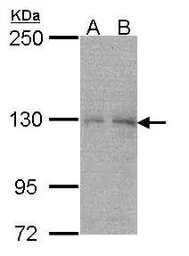 Anti-NYREN18 antibody used in Western Blot (WB). GTX101870
