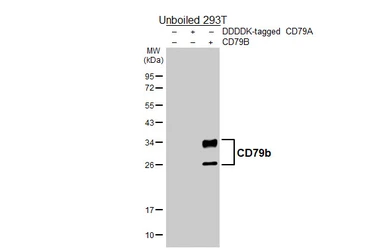 Anti-CD79b antibody used in Western Blot (WB). GTX101873