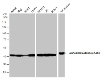 Anti-alpha Cardiac Muscle Actin antibody used in Western Blot (WB). GTX101876