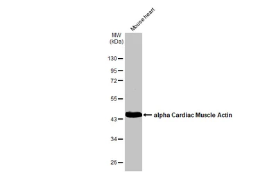 Anti-alpha Cardiac Muscle Actin antibody used in Western Blot (WB). GTX101876