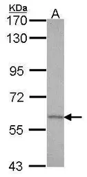 Anti-GAD67 antibody [N3C3] used in Western Blot (WB). GTX101880