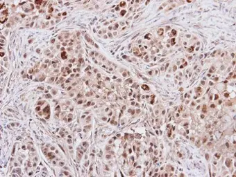 Anti-p70 S6K beta antibody [N1C1] used in IHC (Paraffin sections) (IHC-P). GTX101886