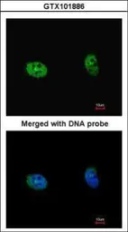 Anti-p70 S6K beta antibody [N1C1] used in Immunocytochemistry/ Immunofluorescence (ICC/IF). GTX101886