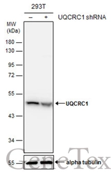 Anti-UQCRC1 antibody used in Western Blot (WB). GTX101896