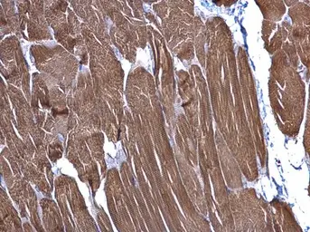 Anti-alpha Cardiac Muscle Actin antibody used in IHC (Paraffin sections) (IHC-P). GTX101900