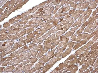 Anti-alpha Cardiac Muscle Actin antibody used in IHC (Paraffin sections) (IHC-P). GTX101900