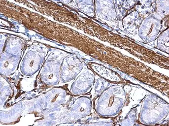 Anti-alpha Cardiac Muscle Actin antibody used in IHC (Paraffin sections) (IHC-P). GTX101900