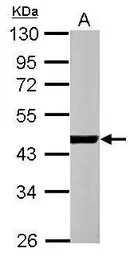 Anti-alpha Cardiac Muscle Actin antibody used in Western Blot (WB). GTX101900