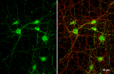 Anti-VGAT antibody [N1N2], N-term used in Immunocytochemistry/ Immunofluorescence (ICC/IF). GTX101908
