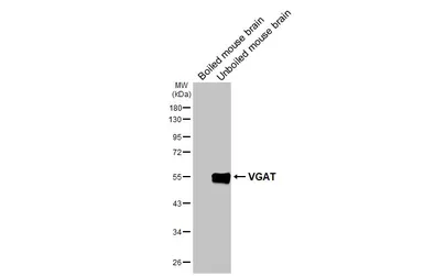 Anti-VGAT antibody [N1N2], N-term used in Western Blot (WB). GTX101908