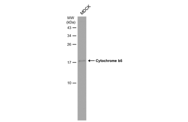 Anti-Cytochrome b5 antibody [N1C3] used in Western Blot (WB). GTX101909
