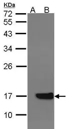 Anti-Cytochrome b5 antibody [N1C3] used in Western Blot (WB). GTX101909