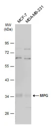 Anti-MPG antibody used in Western Blot (WB). GTX101916