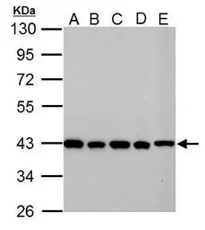 Anti-GOT2 antibody used in Western Blot (WB). GTX101930
